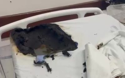 1 de 1 Paciente ateia fogo em outro paciente no Hospital Lourenço Jorge, na Barra da Tijuca
