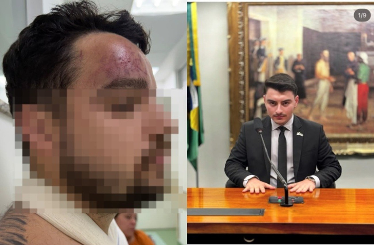 1 de 1 A vítima, Marcelo Ribeiro Delgado Junior, e o homem investigado por agressão, Gustavo Schiphorst