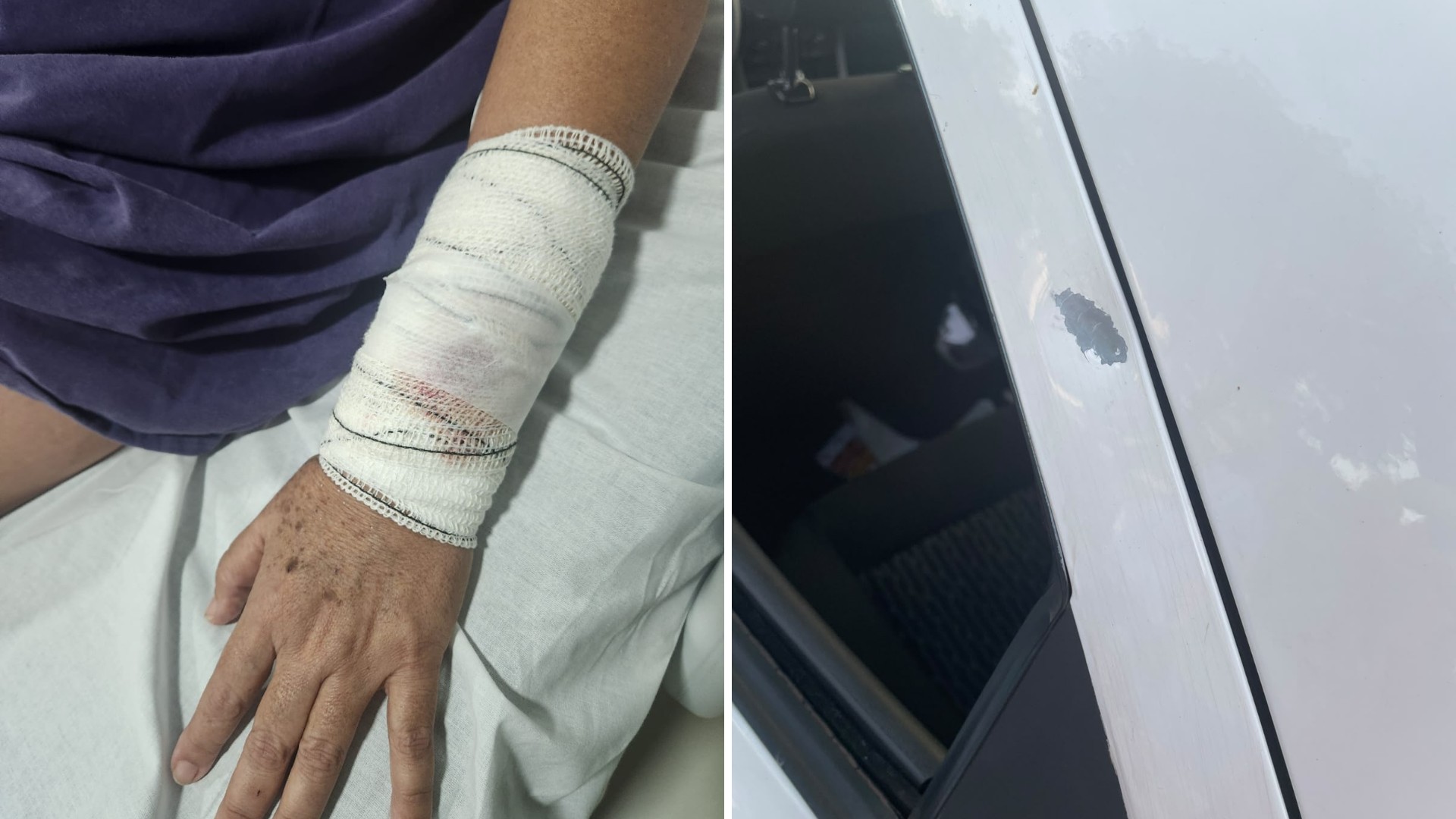 1 de 1 Mulher é atingida por bala perdida durante carreata em apoio a Lula em Bauru