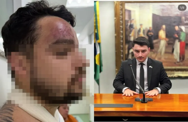 1 de 1 A vítima, Marcelo Ribeiro Delgado Junior, e o homem investigado por agressão, Gustavo Schiphorst