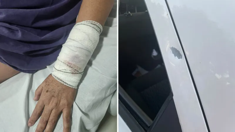 1 de 1 Mulher é atingida por bala perdida durante carreata em apoio a Lula em Bauru